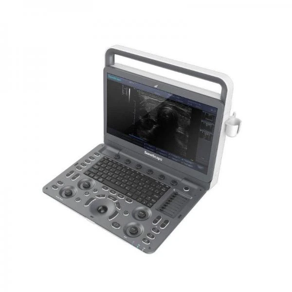Sistema ultrazvukovoy diagnostiki Model: SonoScape E3