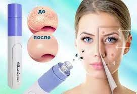Vakuumniy ochistitel por lisa Derma Suction