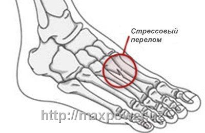 Ботинок бандажный