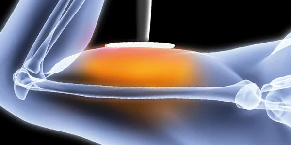 Monopolyarnie,Bipolyarnie i Tripolyarnie sistemi dlya T.Ye.S.A.R. terapiya