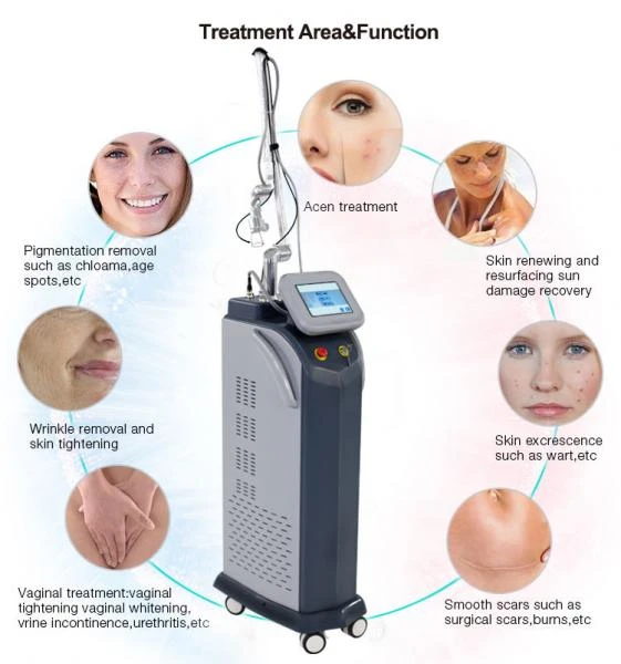 Fraksionniy SO2-lazer dlya podtyajki vlagalisha