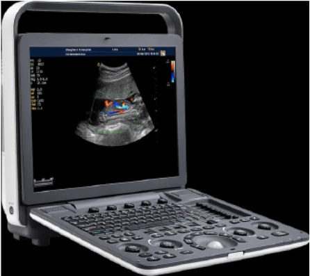 UZI portativnoe MediSono (SSHA) P11 PLUS