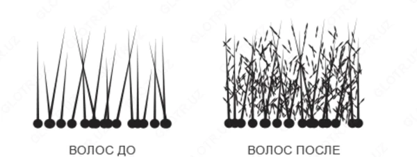 Laringoskop tipa Makintosh 4 klinka
