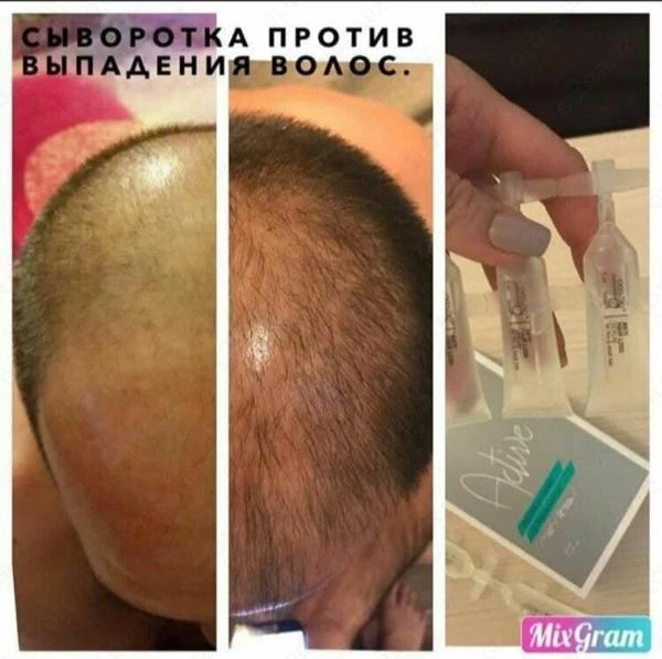 Сыворотка против выпадения волос - Active