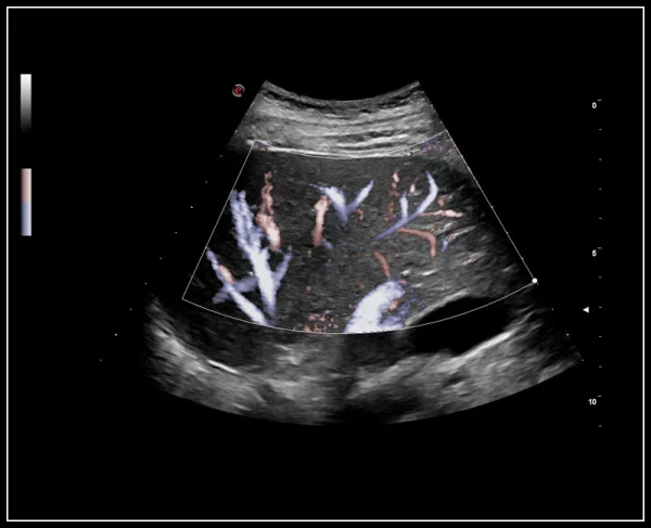 Ультразвуковой томограф нового поколения Esaote MyLab 9 eXp