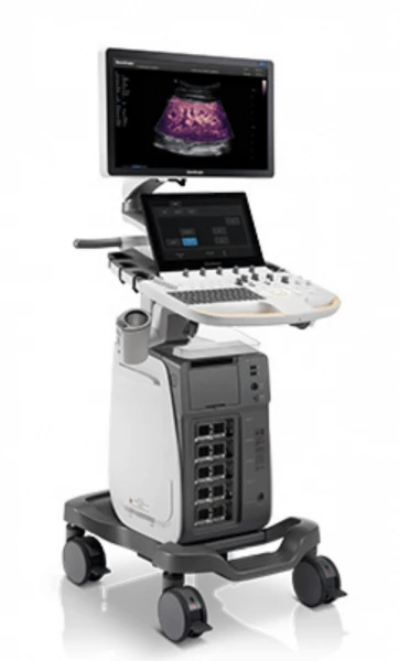 Ultrazvukovoy skaner SonoScape P60