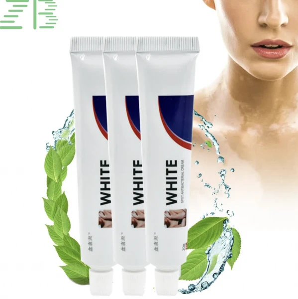 Крем для лечения витилиго White 20 г