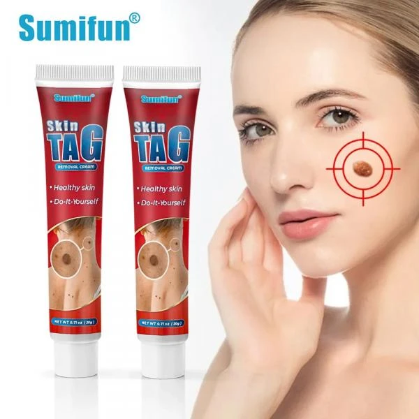 Siğil va papillomalarni olib tashlash uchun krem - 20 g Skin Tag