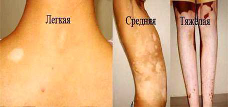 Витаминные препараты Copper