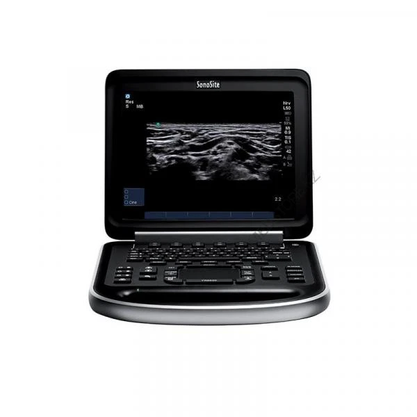 Система диагностическая ультразвуковая портативная HM70A