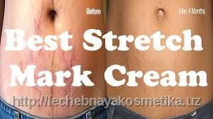 Krem protiv rastyajek Danjia Snail Remove Stretch Marks
