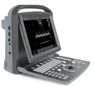 Portativ ultratovush apparati P9 plyus